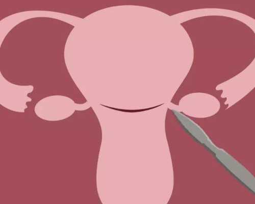 广州代孕代生双胞胎机构|试管婴儿移植前