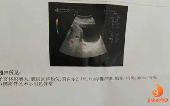 三门峡正规三甲医院代孕,已经做了女扎手术，两胎剖腹产，还可以做试管婴儿