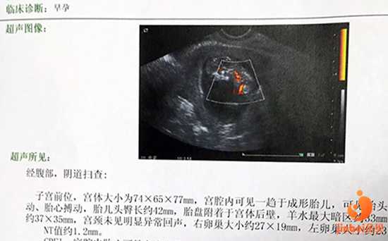 郑州生殖中心供卵条件_【昆华医院做供卵试管婴儿吗】和很多人一样，提前三